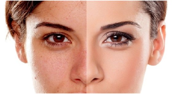 mascarilla para las manchas