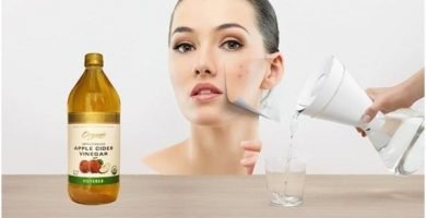 vinagre de manzana para el acné